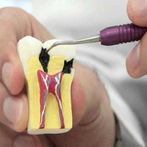 Endodonti